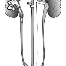 Kidney Stone Risk Panel Lab Tests Online
