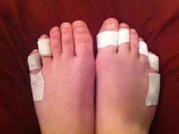These ballerinas are famous, professional & beautiful these ballerinas are famous, professional & beautiful, but their feet are corny,damaged and ugly. How Do Ballet Dancers Avoid Breaking Their Toes Whilst Dancing En Pointe Quora