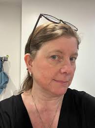 Are there any Canadian products I could use for my Rosacea?