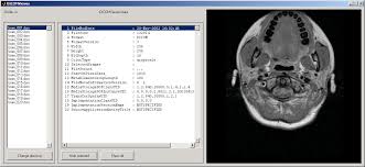 Have a look in the dicom header of your medical image files, structured reports, waveforms or any. Dicom Viewer File Exchange Matlab Central