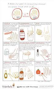 9 More Diy Ways To Painlessly Remove Splinters From Your Skin Splinter Removal Getting Splinters Out How To Remove