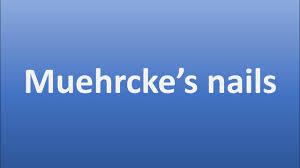 Image result for Muehrcke Line