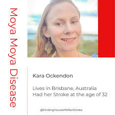 Meet Matthew Weingartner, who lives in Long Island, New York. Endocarditis  was the underlying factor for his stroke at the age of 30. He has Aphasia.  Matt has a YouTube channel called "