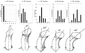 Image result for Chordee