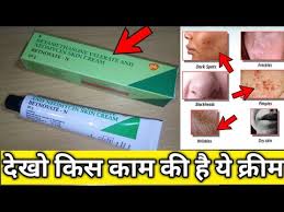 Betnovate N Latest Price Dealers Retailers In India This review is helpfull for u. betnovate n latest price dealers