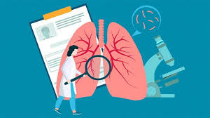 Like other cancers, lung cancer develops when normal processes of cell division and growth are disrupted, giving way to abnormal, uncontrollable growth. What Are The Causes Of Lung Cancer Everyday Health