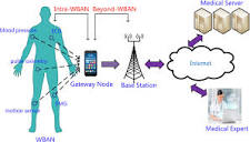 Illustration of a WBAN-based solution architecture for remote ...