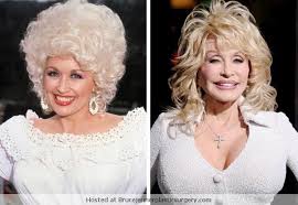 Dolly Parton Plastic Surgery Before And After Dolly Parton Plastic Surgery Celebrity Plastic Surgery Plastic Surgery