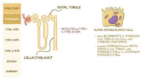 Possible rta meaning as an acronym, abbreviation, shorthand or slang term vary from category to. Renal Tubular Acidosis Pathology Review Video Explanation Osmosis