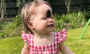 Przyszła na świat z nietypowym znamieniem. Przeszła operacje. 'Najcięższa  decyzja w życiu'