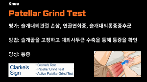 Image result for Patella Grind Test