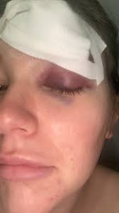 LukeBarton (@lukebartonn)