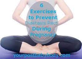 You might be more likely to develop diastasis recti as a result of pregnancy if you have carried multiples or a large baby to term and are of small stature and fit or are age 35 or older. Pin On Exercise After Baby