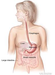 Hereditary Diffuse Gastric Cancer Medlineplus Genetics