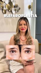 “Quais os tipos de anestesia?”, “Posso ir pra casa no mesmo dia?”, “Quantos  dias vou ter que ficar de repouso?”, ‼️Essas são, disparado, as dúvidas que  eu mais escuto por aqui quando o assunto é ...