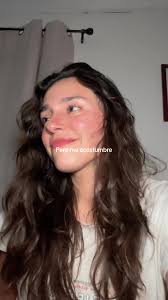 Y Te Volviste La Excepción Letra