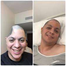 Heartwarming Story of Love and Support After Quadriplegic Accident