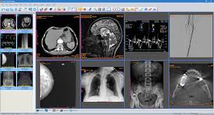 It can load data in dicom format (single image dcm) and provides standard tools for its based on dcm4che and imagej. Top 25 Free Dicom Viewers For Doctors Medical Students And Health Professionals Postdicom