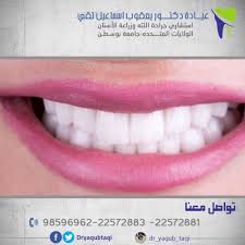 لابتسامة ساحرة نقدم لك خصم علي تقويم الأسنان يوجد تقسيط عن طريق بيت التمويل الكويتي عيادة دكتور يعقوب اسماعيل تقي 22572881 22572883 98596962 بنيدالقار شارع