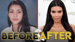 How many kim kardashian plastic surgery procedures were there? Kim Kardashian Before And After Transformations Kuwtk Youtube