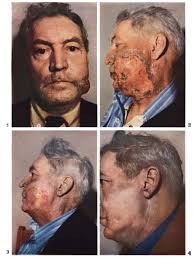 放射線医学の歴史