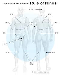 burn percentage in adults rule of nines chart