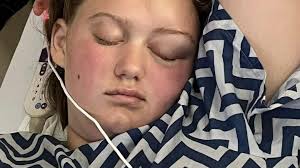 Fundraiser by Brandon Abrams : Rally for Paityn's Brain Tumor Recovery