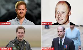 Prince Harry's hair loss has ...
