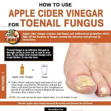 Remedies For Toenail Fungus Is Apple Cider Vinegar Good For Toenail Fungus Toenailf Apple Cider Vinegar Remedies Apple Cider Vinegar Foot Soak Toenail Fungus