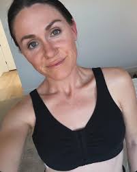 Breast implant removal and recovery experiences