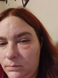 What could be causing eye irritation in Puerto Vallarta?