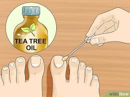 A fungal infection of the toe or finger nails often results from a chronic athlete's foot infection in our youthful years. 3 Ways To Prevent Nail Fungus Wikihow