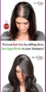 Pura d'or shampoo and conditioner addresses hair follicle growth and health with niacin, argan oil, and biotin. Best Shampoo For Hair Growth And Thickening Natural Hair Loss Hair Loss Shampoo Help Hair Loss