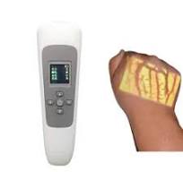 Vein Finder Light-China Vein Finder Light Manufacturers ...