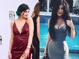 But did you know she also has an impressive real estate portfolio?. Kylie Jenner Im Beauty Op Rausch Falsche Lippen Falsche Bruste Intouch