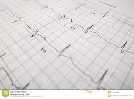 Slective Focus Of Heart Test Ekg Sheet Stock Photo Image