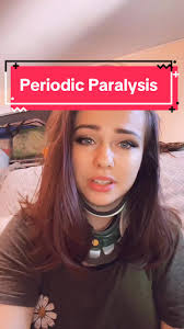 My inbox is always open for questions, and im happy to help! I know i am  incredibly lucky to have found a diagnosis in only two years, when so many  are still struggling #hypokalemia #hyperkalemia ...