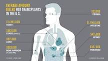 Image result for how much does medicare pay for heart transplant