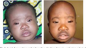 Image result for Blepharis transvaalensis