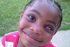 Fundraiser by Qaedah Perron : Cyan Perrons Prosthe Eye Transplant