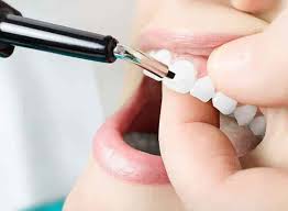 Dr. Annu Kumar (Origin Dental Implant Centre) in Nagawara,Bangalore