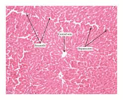 Image result for Pseudospondias microcarpa