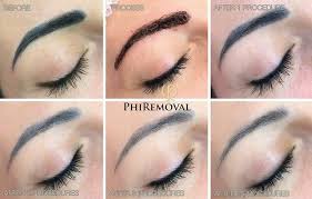 How permanent tattoos are removed. Permanent Makeup Removal Organic Spa Houston