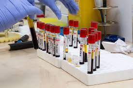 Centru de analize medicale in satu mare, preturi mici la teste uzuale si analize de diagnostic avansat. Laborator Analize Medicale Star Medica Clinica Satu Mare