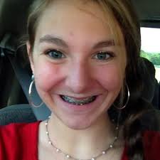 Anchor Splash Donations Benefitting Service for Sight