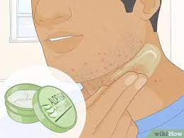 How To Get Rid Of Razor Bumps On Your Neck: 13 Easy Remedies