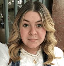 It shouldn't have taken me 30 years to love my moles