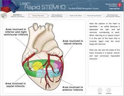 Check spelling or type a new query. Stemi Heart Attacks The Real Dangers Myheart