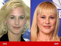 She has been the recipient of numerous accolades, including an academy award, a british academy film award, two primetime emmy awards, three golden globe awards, and two screen actors guild awards. Patricia Arquette Good Genes Or Good Docs Binge Post