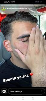محمد سيد زيزو كاد يضيف الهدف الثالث في ظل بهتة من دفاع الترجي. ØµÙˆØ±Ø© Ø£Ø­Ù…Ø¯ Ø³ÙŠØ¯ Ø²ÙŠØ²Ùˆ ÙŠØªØ¹Ø±Ø¶ Ù„Ù„Ø¥ØµØ§Ø¨Ø© Ù‚Ø¨Ù„ Ø§Ù„Ø³ÙˆØ¨Ø± Ø§Ù„Ù…ØµØ±ÙŠ